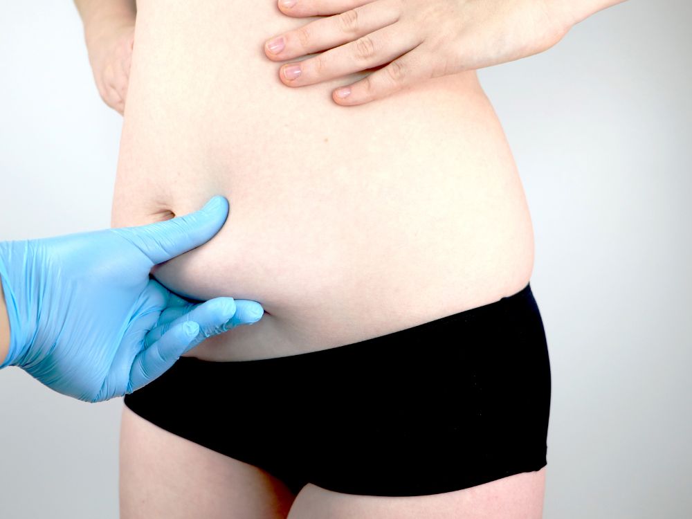 Abdominoplastia e silicone podem remodelar o corpo.