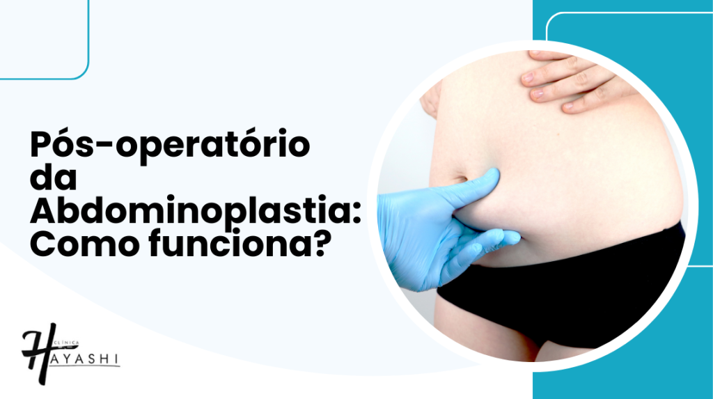 Pós-Operatório Abdominoplastia