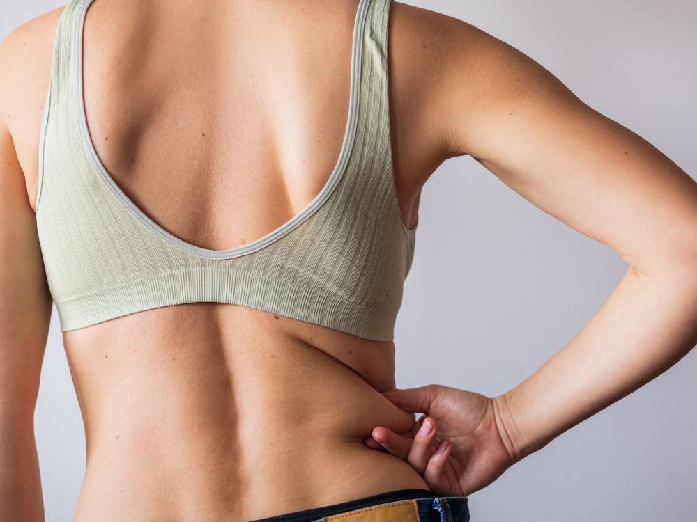Mulher apontando para gordura localizada nas costas. Ilustração associada a com quantos anos pode fazer lipoaspiração.