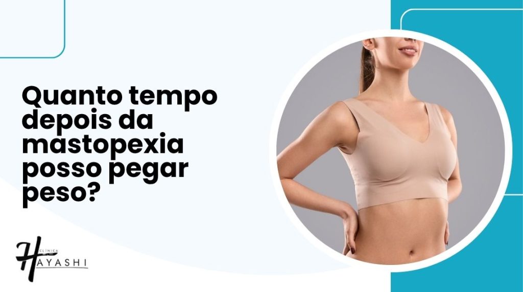 Capa informativa com a pergunta “Quanto tempo depois da mastopexia posso pegar peso?” ao lado de mulher usando sutiã cirúrgico pós-operatório.