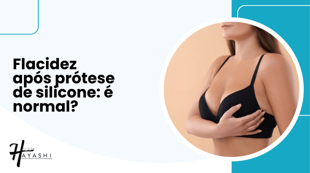Mulher com top preto avaliando a mama, ilustrando a dúvida sobre flacidez após prótese de silicone ser ou não algo normal.