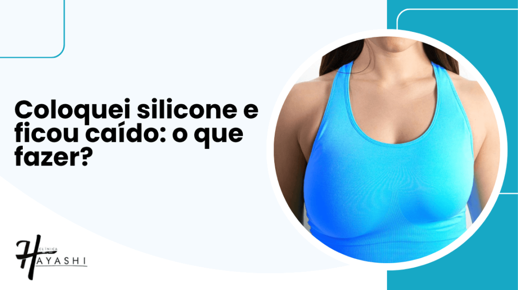 Imagem de mulher com top azul mostrando resultado mamário após prótese, ilustrando dúvida comum: Coloquei silicone e ficou caído, o que fazer?