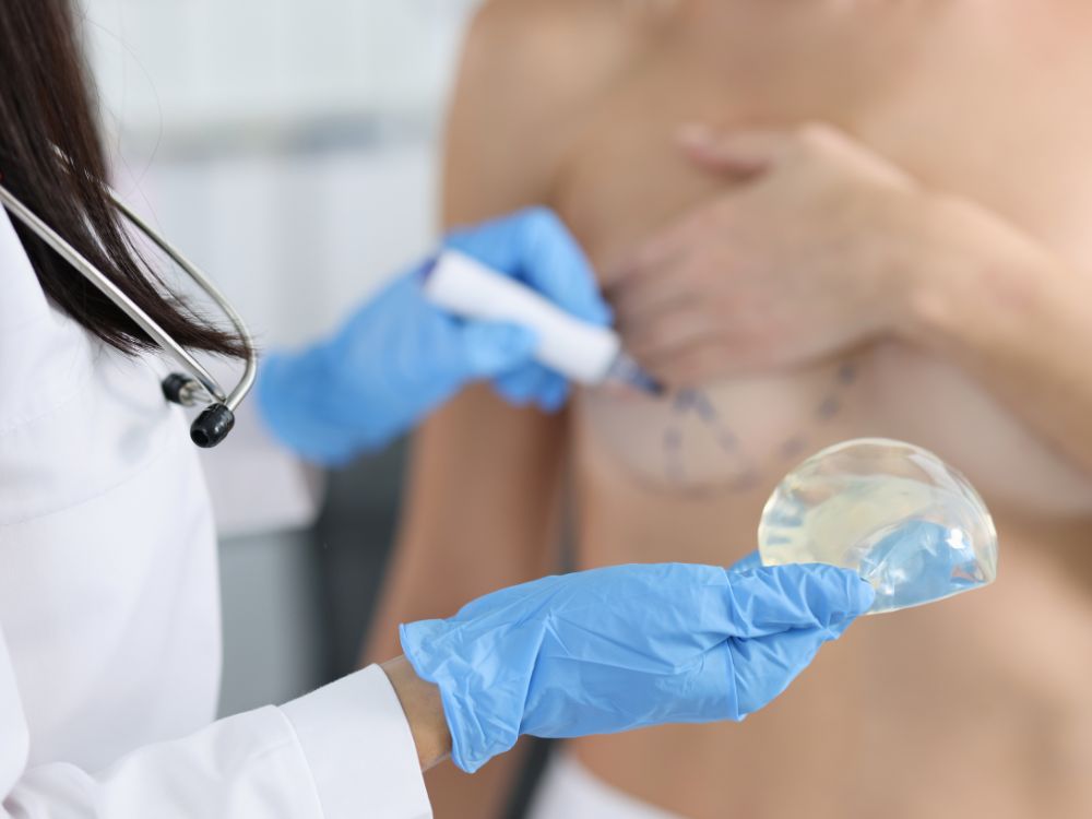 Médica mostrando prótese de silicone enquanto marca a mama da paciente para avaliação e planejamento cirúrgico.