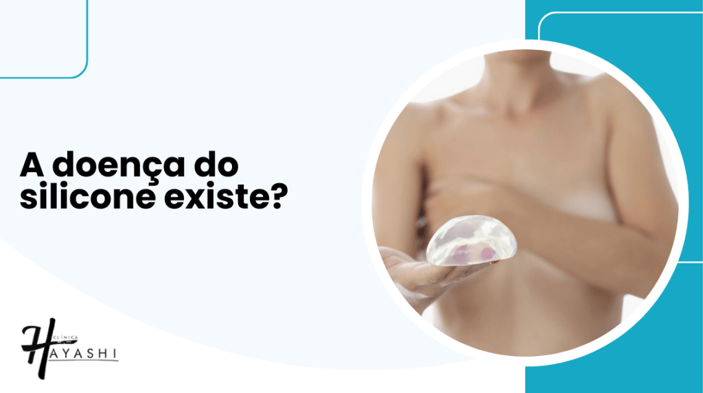Mulher segurando prótese de silicone em destaque em material informativo sobre se a doença do silicone existe e suas possíveis relações com sintomas.
