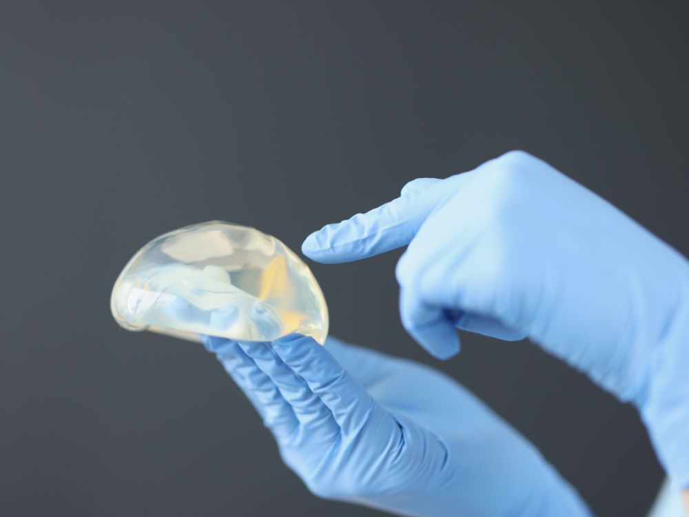 Do que é feito o silicone de mama ilustrado por prótese mamária manipulada com luvas cirúrgicas, indicando segurança, composição e uso médico do implante.