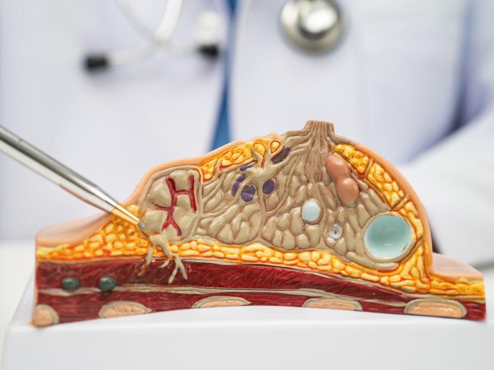 Técnica de mamoplastia com incisão ao redor da aréola, usada em procedimentos estéticos e reconstrutivos, explicando Periareolar o que é
