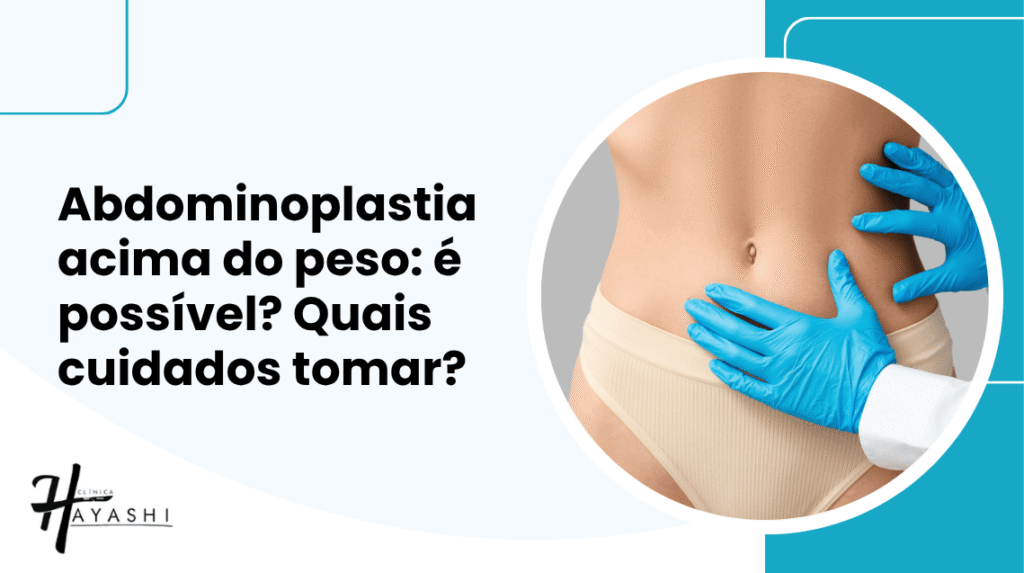 Profissional realiza avaliação da região abdominal antes da abdominoplastia em paciente com excesso de pele e flacidez.