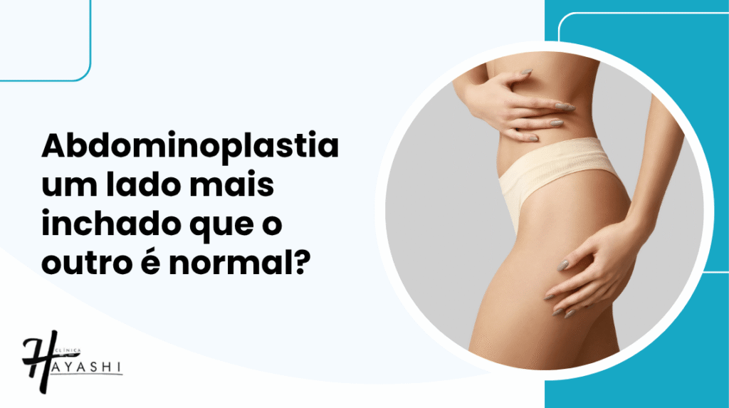 Mulher segura a lateral do abdômen e da cintura, ilustrando dúvidas sobre se a abdominoplastia um lado mais inchado que o outro é normal
