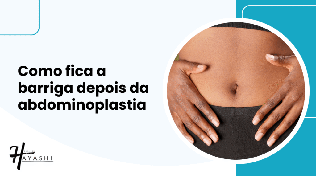 Capa do artigo sobre como fica a barriga depois da abdominoplastia com imagem de abdômen e título em destaque.