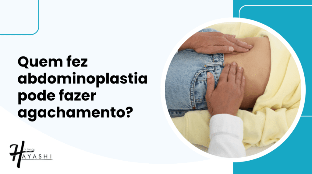 Capa do artigo explica se quem fez abdominoplastia pode fazer agachamento e aborda o retorno aos exercícios.