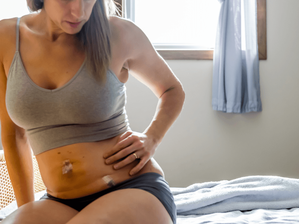 Mulher sentada examina a região abdominal, onde há curativos após uma cirurgia, durante o período de recuperação pós-operatória.