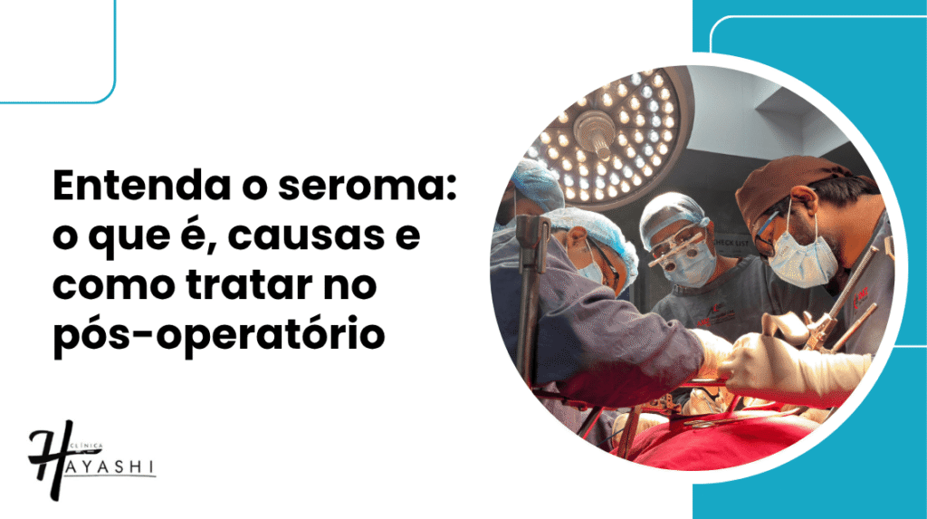 Capa do artigo sobre seroma, com fotografia de uma equipe médica durante cirurgia e o título sobre causas e tratamento no pós-operatório.