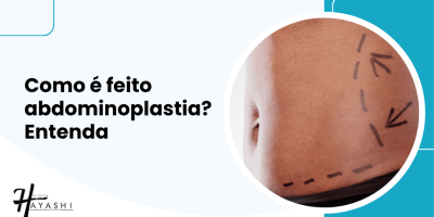 Capa do artigo sobre como é feito abdominoplastia, com imagem de abdômen marcado para cirurgia e título em destaque.