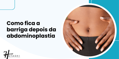 Capa do artigo sobre como fica a barriga depois da abdominoplastia com imagem de abdômen e título em destaque.