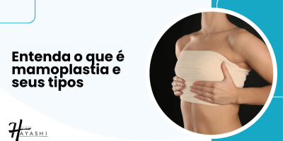 Imagem ilustrativa com frase "Entenda o que é mamoplastia e seus tipos" ao lado de mulher com faixa de compressão no tórax após cirurgia de mama.