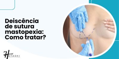 Imagem ilustrativa sobre deiscência de sutura mastopexia com foco em como tratar a complicação no pós-operatório de cirurgia plástica.