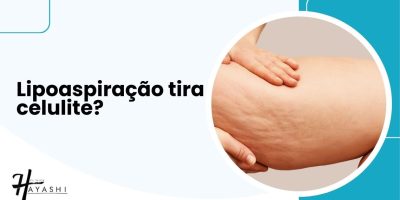 Imagem com a pergunta "Lipoaspiração tira celulite?" ao lado de uma coxa com celulite visível. A Clínica Hayashi explica a relação entre lipoaspiração e celulite.