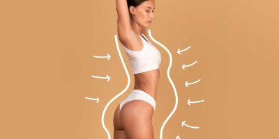 Lipoaspiração