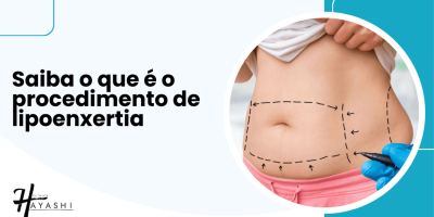 Banner com o título “Saiba o que é o procedimento de lipoenxertia” e imagem de abdômen com marcações cirúrgicas para retirada de gordura.
