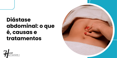 Capa do artigo sobre diástase abdominal, com uma mão tocando a região do ventre e o título sobre causas e tratamentos.