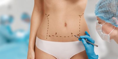 mulher-marcada-para-cirurgia-estetica (1)