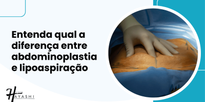 Arte com título sobre a diferença entre abdominoplastia e lipoaspiração, acompanhada de imagem de cirurgia abdominal.